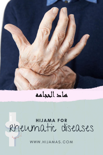 Hijama for rheumatic diseases and hijama for arthritis