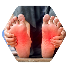 Cupping for plantar fasciitis cupping plantar fasciitis hijama for plantar fasciitis plantar fasciitis cupping therapy plantar fasciitis treatment cupping plantar fasciitis treatment in hyderabad