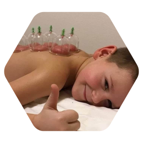 Babies hijama cupping kids hijama for kids kids cupping therapy