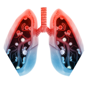 Best hospital for lungs treatment in hyderabad best lungs hospital in hyderabad best lungs specialist in hyderabad cupping for lungs cupping lungs cupping to clear lungs hand cupping therapy for lungs hijama for lungs lungs hospital in hyderabad lungs specialist doctor in hyderabad lungs specialist hospital in hyderabad lungs specialist hyderabad lung detox after smoking smoking lungs detox smoking addiction treatment detox for smoking lung detox after quitting smoking treatment for quit smoking nicotine addiction treatment natural nicotine detox treatment to purify blood from nicotine smoking treatment nicotine treatment